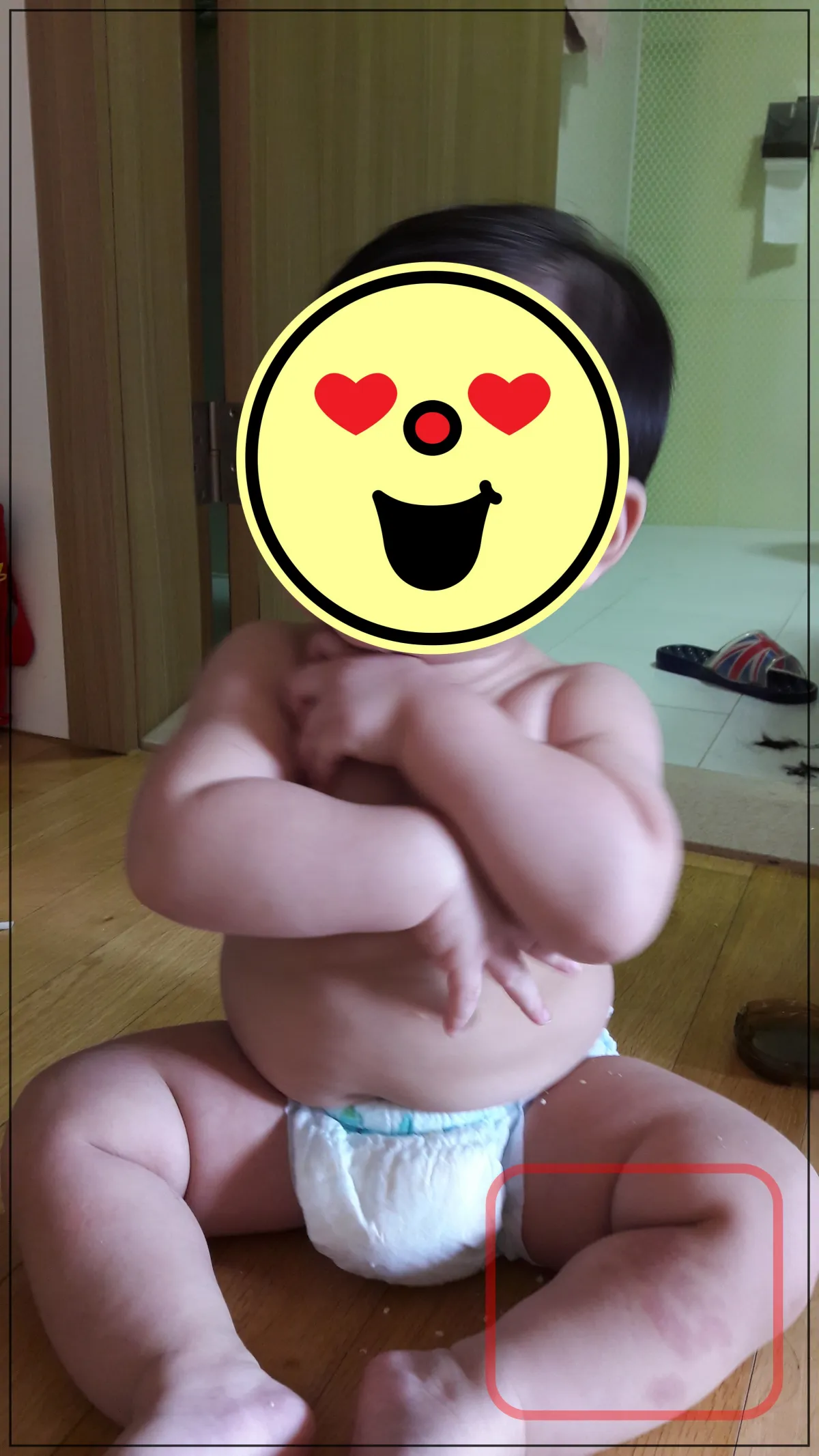 화장실-문이-열려있고-슬리퍼가-있음-화장실-앞에-기저귀만-차고-있는-아이가-앉아있음-얼굴은-이모티콘으로-가려져있고-다리-종아리쪽에-붉은점이-보임