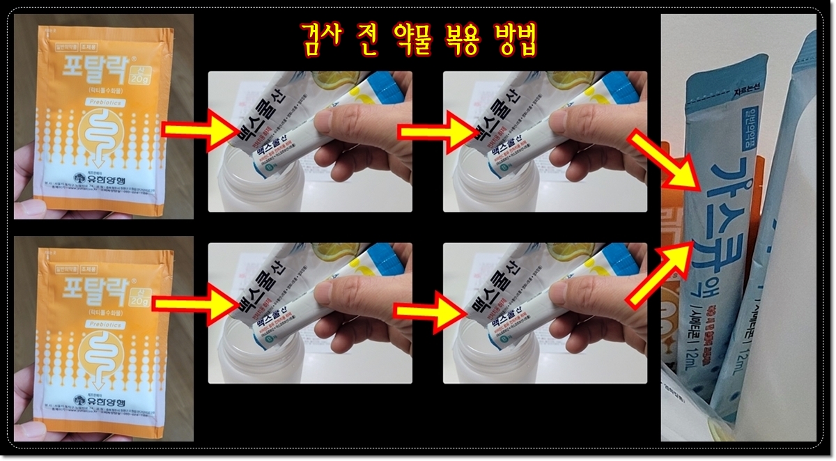 수면-대장내시경-검사-전-약물-복용-방법