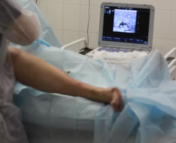 위궤양 조직검사 진단기준 합병증 예방