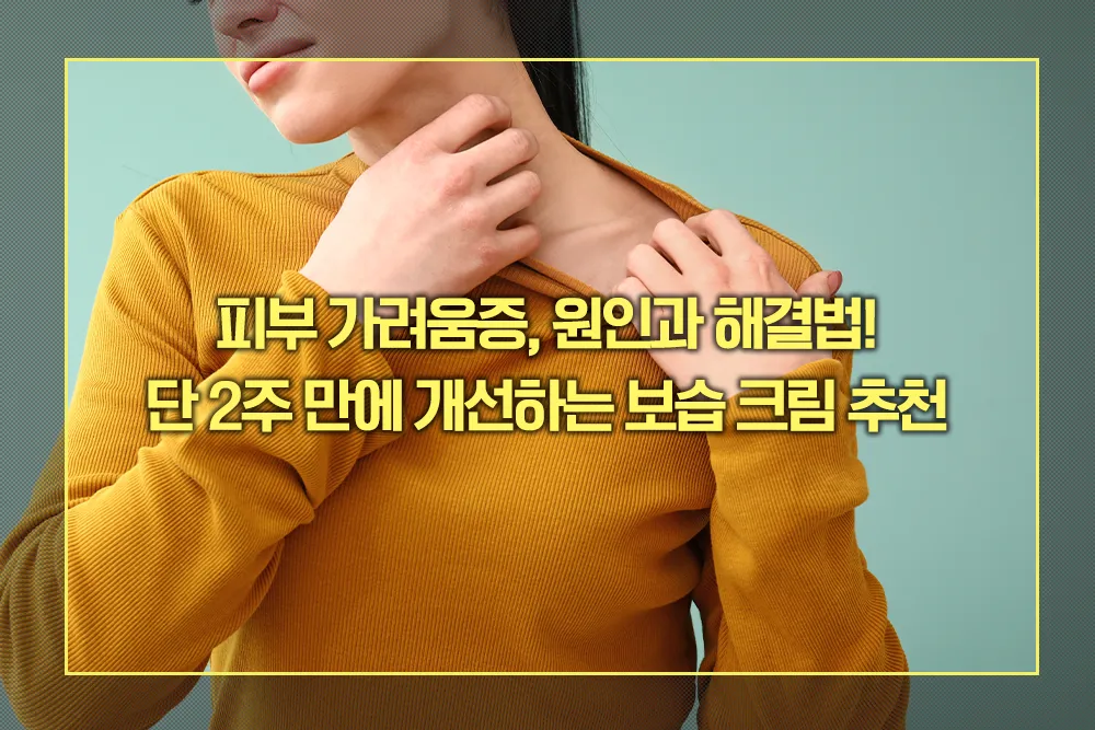 피부 가려움증 원인 해결법 보습 크림 추천