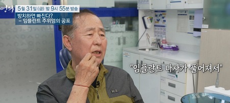 임플란트틀니사용자