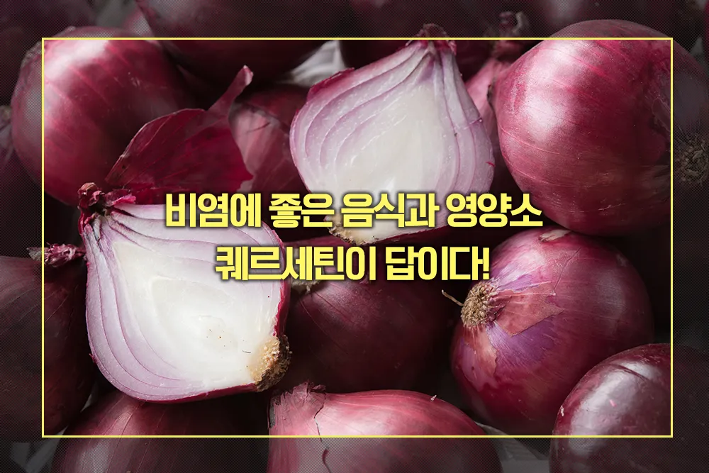 자색 양파 퀘르세틴 비염 치료 효과적인 이유