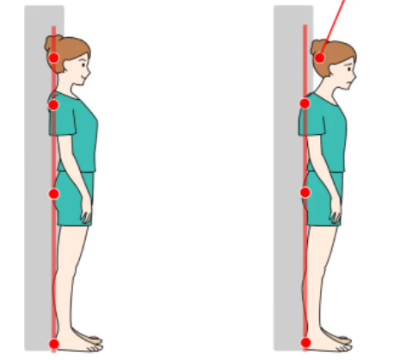 "스트레이트 넥 " 간단 체크