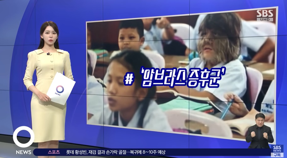 다모증에 대한 여성의 변화