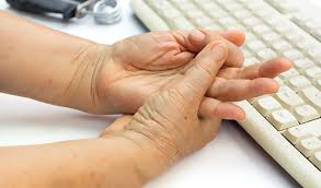 방아쇠수지증후군 썸네일