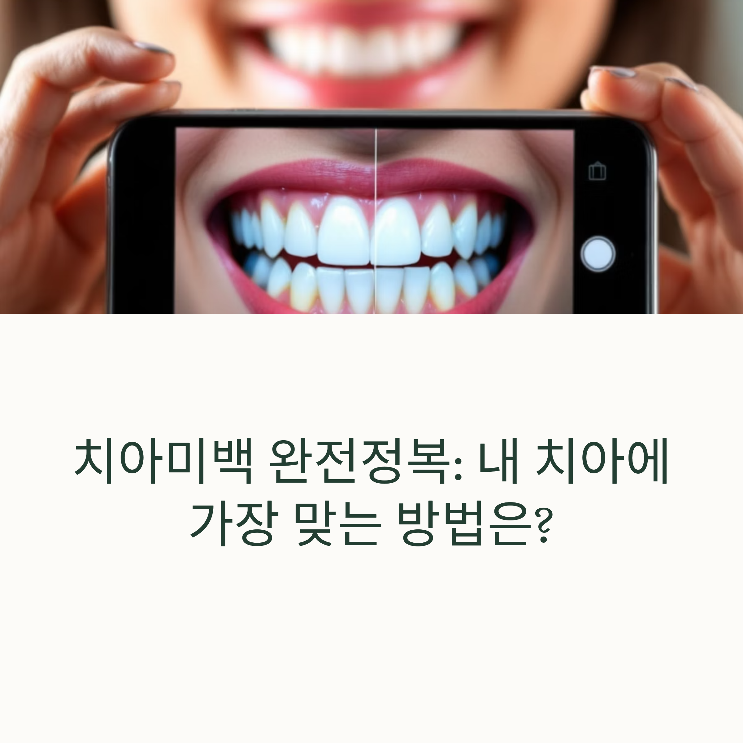 치아미백 가격과 종류 총정리