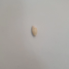 유치-과잉치-발치-사진