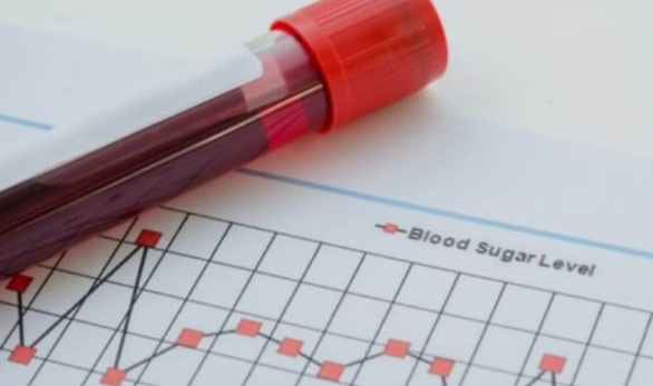 당뇨전단계-증상