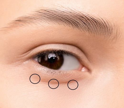 눈-밑-마사지-부위