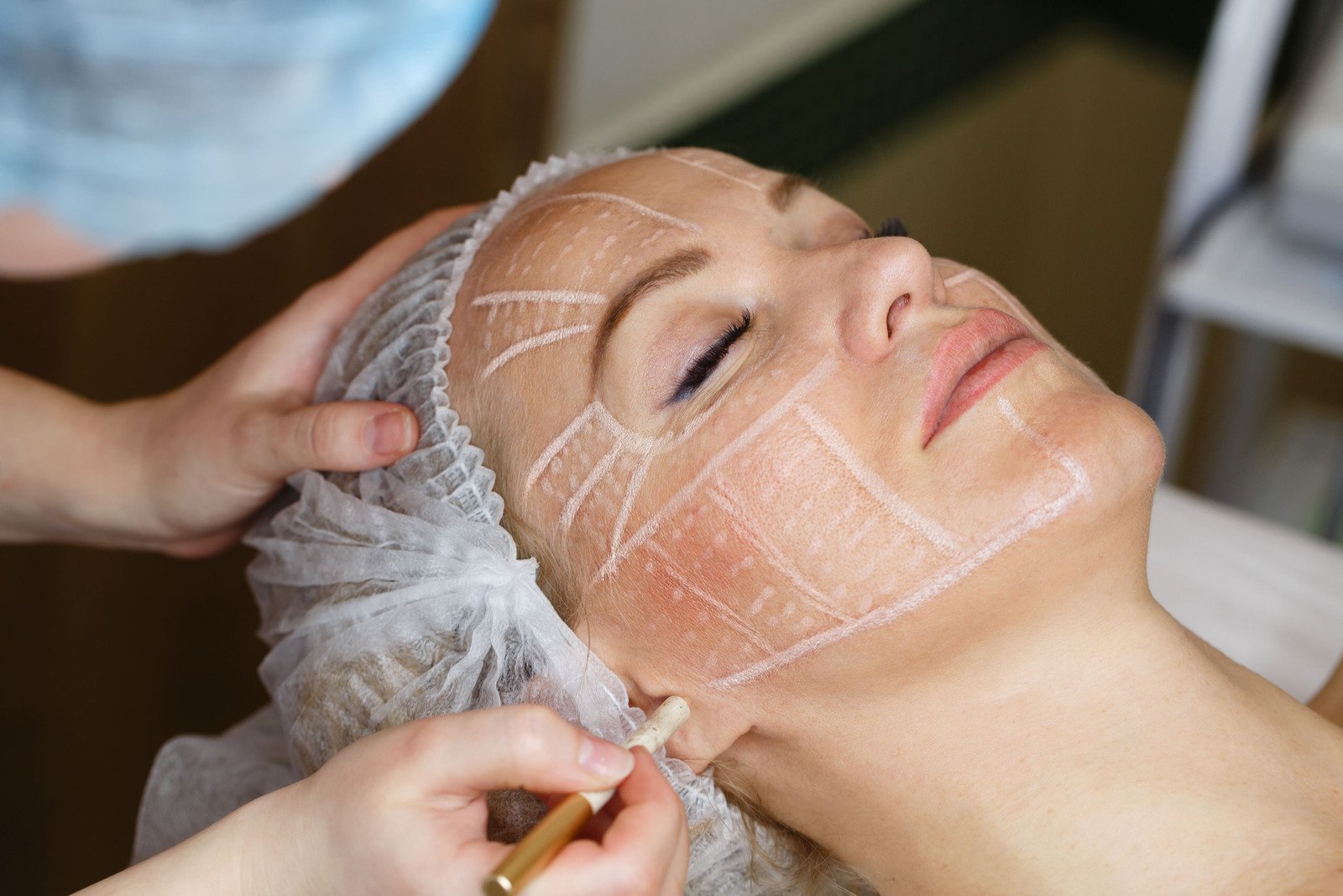 미니 리프팅: 간단하면서 효과적인 안면 리프팅 시술