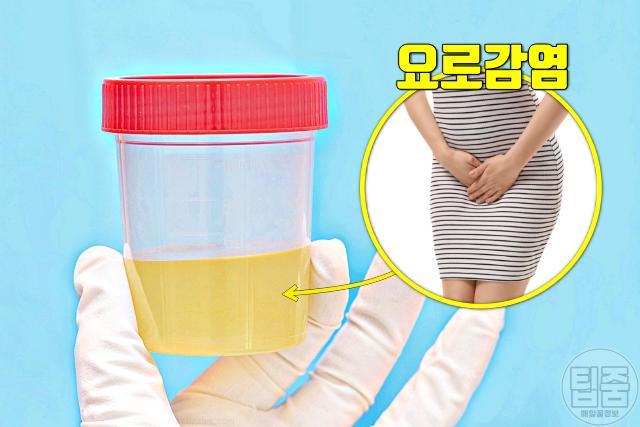 요로감염 증상 소변색깔 뿌옇고 냄새