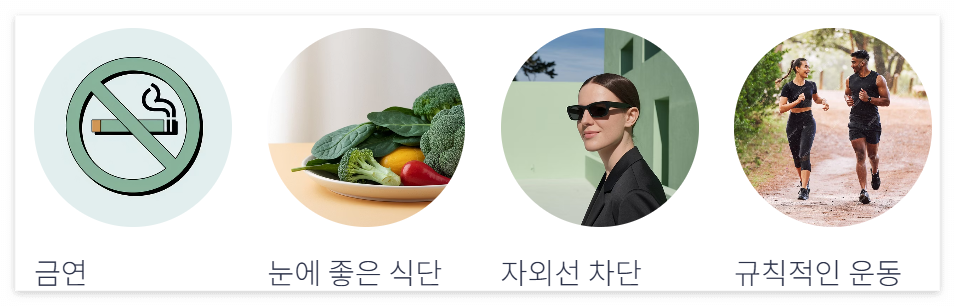 황반변성 예방방법