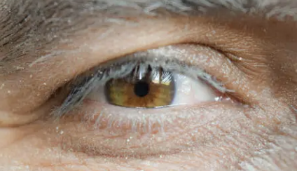 간경화 초기증상 13