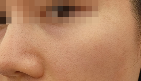 아이올리지오 후기