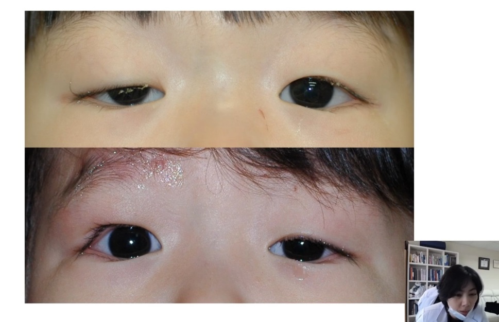 성형안과-윤진숙-교수