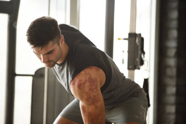 콜린성두드러기 땀과 체온이 만든 가려움의 덫