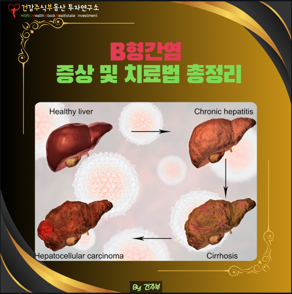 B형간염 증상 및 치료법
(글 그림 : 건주부, 그림 출처 : Canva)