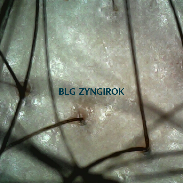 피나모아 복용 21주차 -정수리와 이마사이 부분 두피 모습이다.