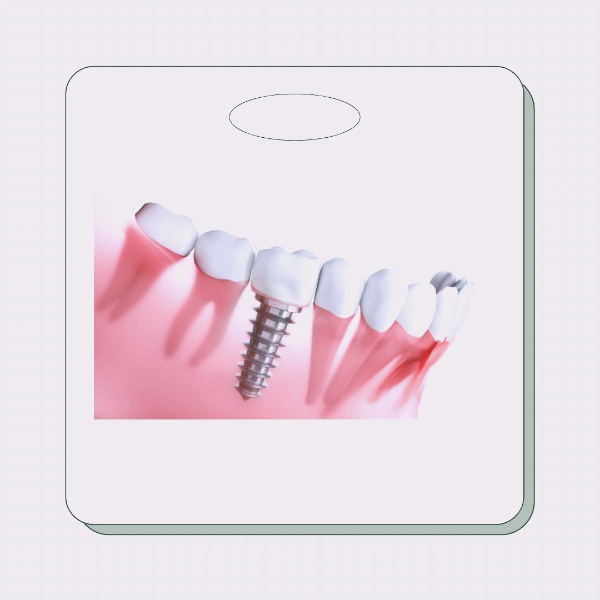 경기도 임플란트 지원금