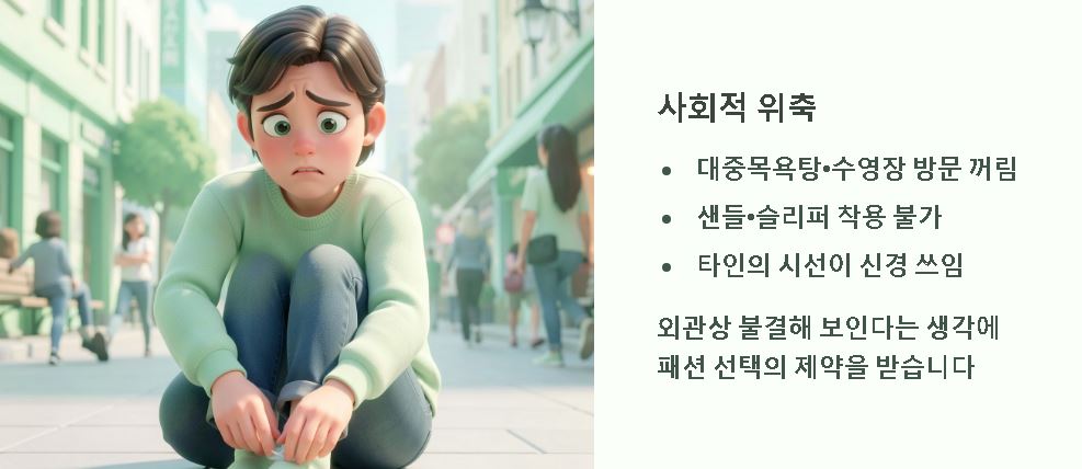 발톱 무좀 증상 초기신호