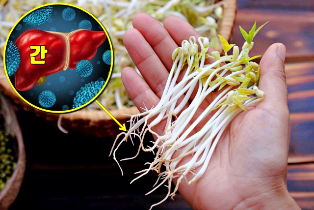 콩나물꼬리 효능 간암, 암이 최고 싫어하는 채소 끝 부위, 건강, 팁줌 매일꿀정보