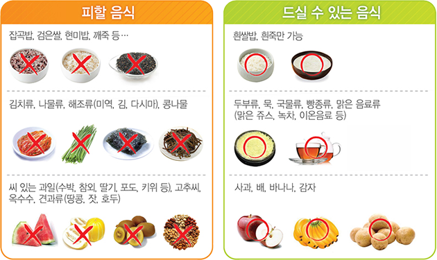대장내시경 전 음식주의사항