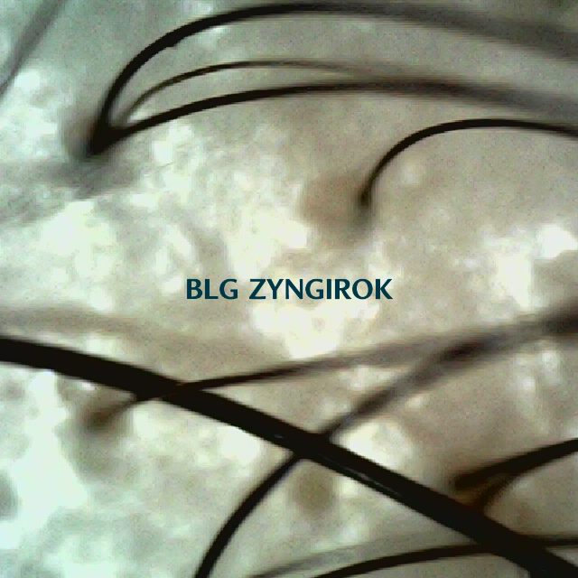 피나모아 복용 4주차 정수리와 이마 사이 두피 모발 사진이다.