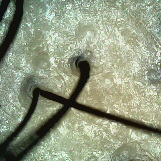 탈모 극복 프로젝트 - 정수리 두피 모습이다.