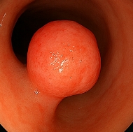 선종 뜻 선종과 용종의 차이