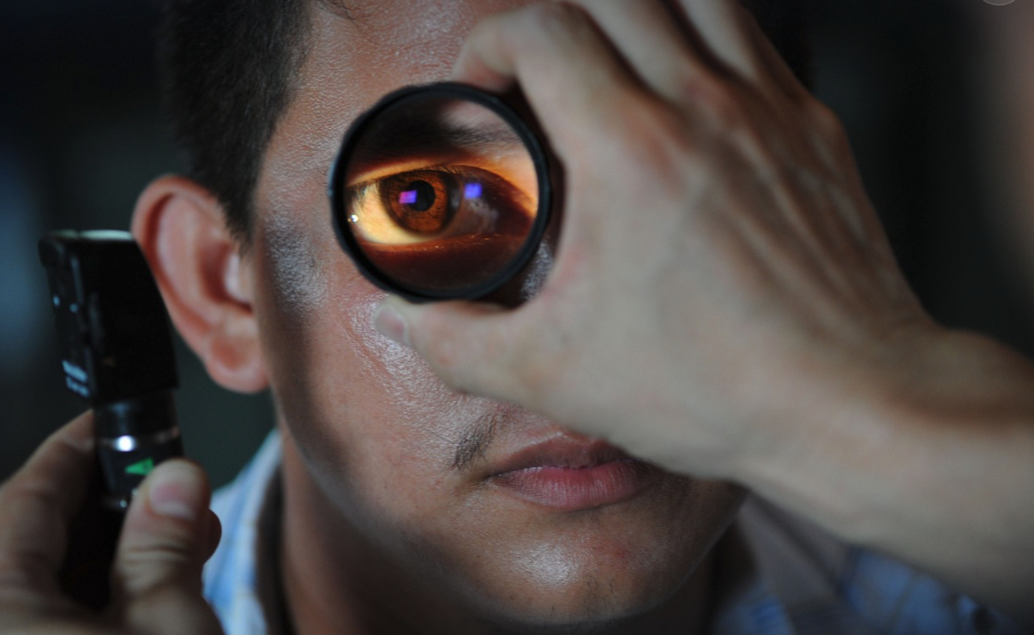 백내장 초기증상 수술비 정부지원 원인 증상 부작용