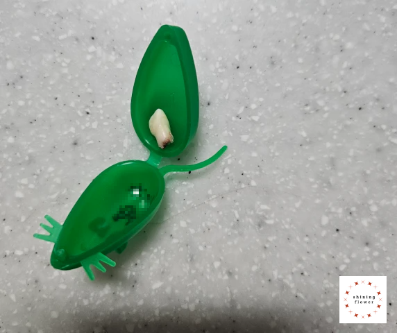 첫째 아이의 늦게 발치한 앞니 유치