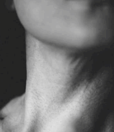 임파선암 초기증상과 생존율