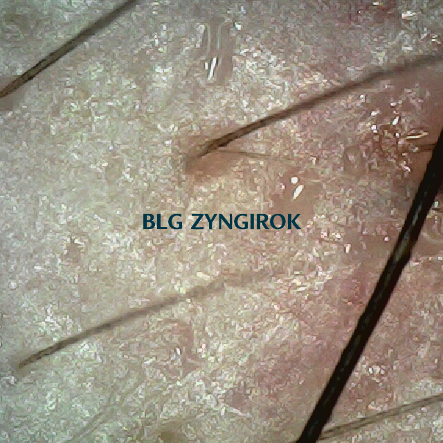 피나모아 29주차 - 오른쪽 M자 부위 두피 모습이다.