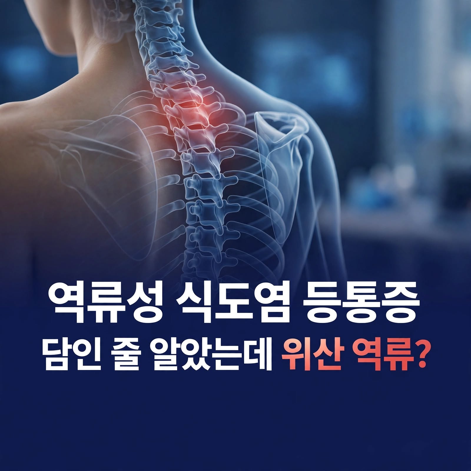 역류성 식도염 등통증 원인과 방사통 증상 구분법