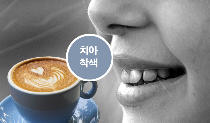 치아착색