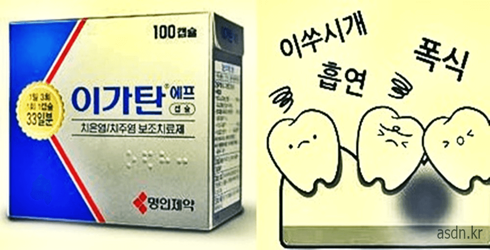 이가탄 효능 효과,성분,가격,부작용 총정리