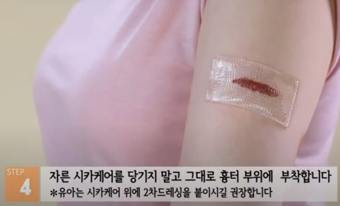 시카케어 겔시트 약국에서 사서, 제왕절개 배 흉터 관리했어요.