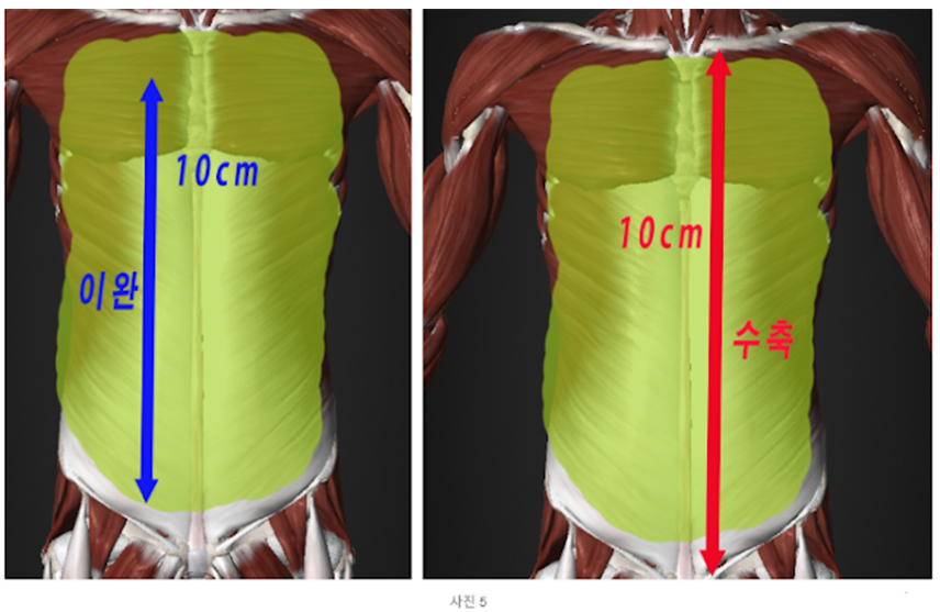 복근 이완 수축