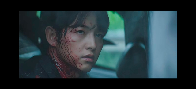 피흘리며 허공을 바라보는 배우