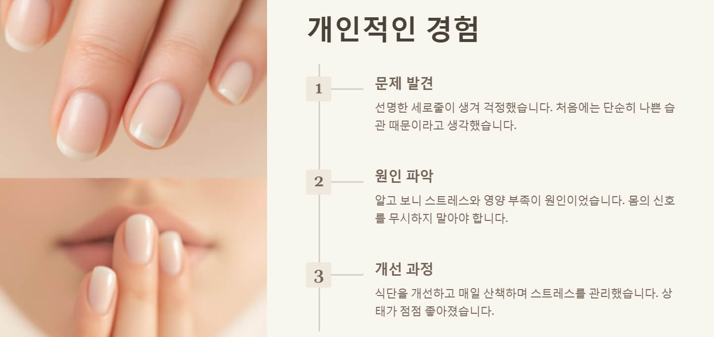 손톱에 세로줄이 생기는 이유