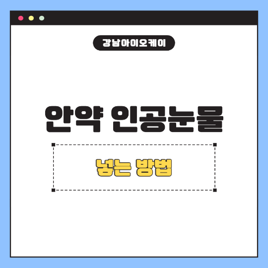 안약-인공눈물
