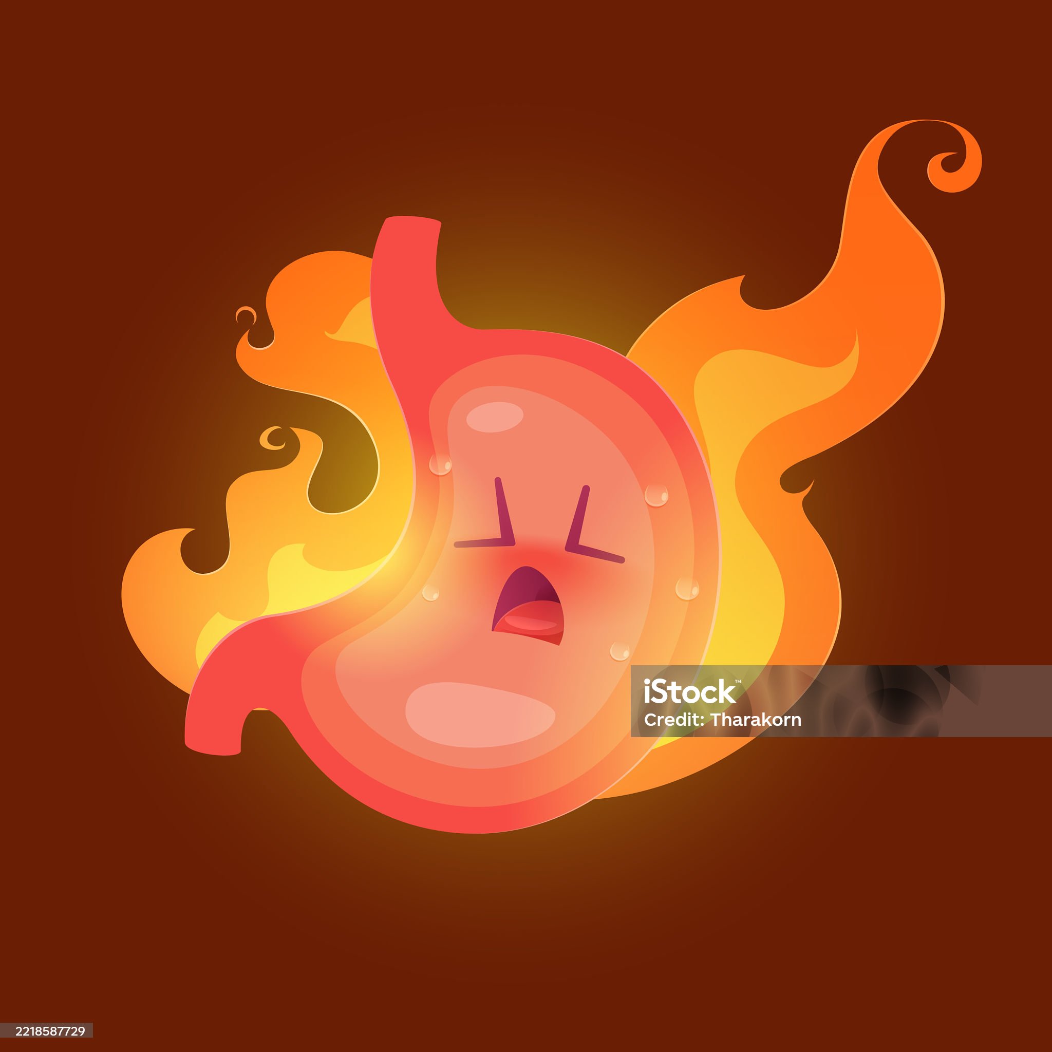 십이지장궤양-관련-사진