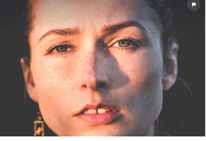 기미가 생기는 원인