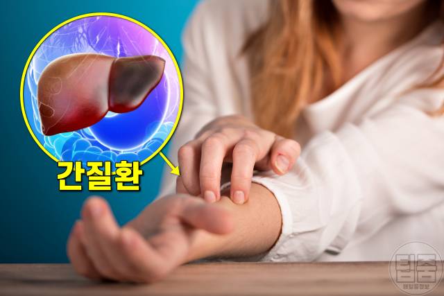 피부가 가려운 이유,지방간 간염 간경화 간암,가려움증 원인