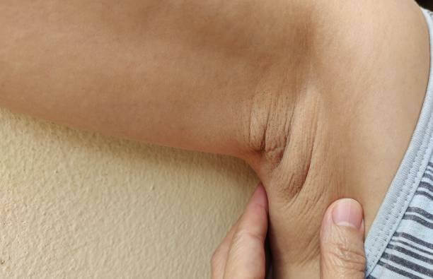 겨드랑이 멍울&amp;#44; 통증 원인 및 예방법입니다. 멍울로 인한 통증과 불편함은 상당히 심각한 문제일 수 있습니다. 하지만 걱정하지 마세요. 이 글에서는 겨드랑이 멍울의 원인과 예방법&amp;#44; 그리고 치료 방법을 알려드리겠습니다. 이제부터 멍울 걱정은 이제 그만! 겨드랑이 건강을 지켜보세요.