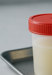 소변 색깔로 보는 건강 &amp;#124; 정상 색&amp;#44; 이상 신호&amp;#44; 병원 방문 기준