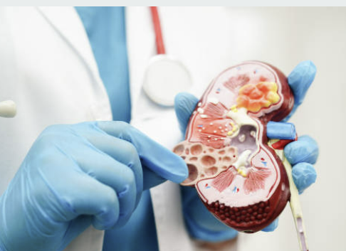 신장에 좋은 음식 신장 안좋으면 나타나는 현상 등 알아보기(24년 Ver)