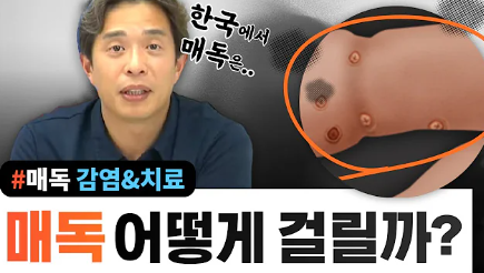 매독 증상 및 감염 경로 (+ 원인 치료 검사 잠복기)