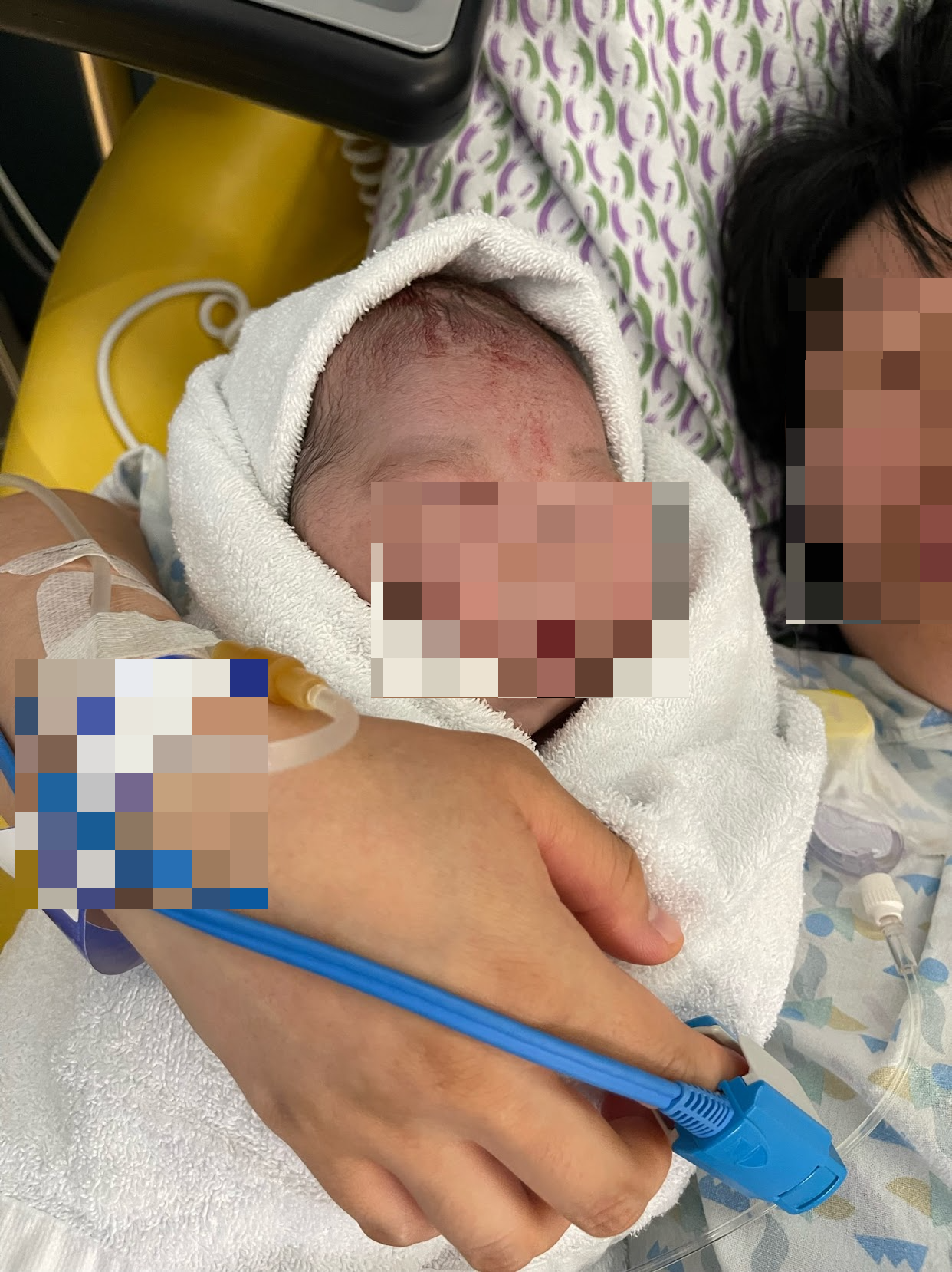 캥거루 케어 없이 수건에 둘둘 말아 처음으로 세상에 나온 아기를 안게 되었다. 가슴으로 안고 싶었건만.