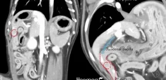 강아지 췌장암 증상 진단 치료법 안내_2